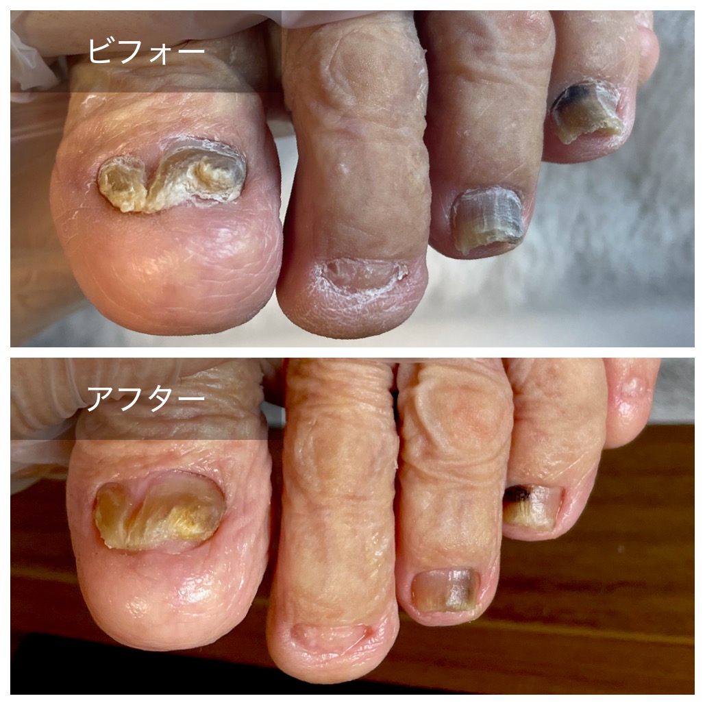 串間や日南へ訪問爪切りに伺います！